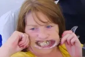 脑洞真大！英国女子为省钱竟然用502粘断牙图片