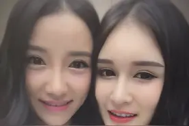 忍无可忍无需再忍！赵本山网红女儿被骂整容靠爹 怒晒黑粉账号图片