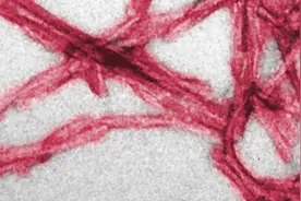 导致疯牛病、痴呆症的阮病毒，致病作用与铜离子有关！图片