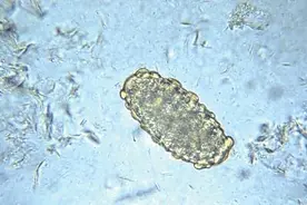 吞寄生虫卵竟能治病图片