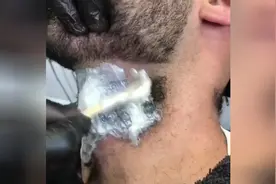 这样清理脖子上的胡子也太酸爽了！视频封面