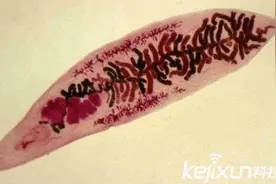 恐怖！十大变态动物杀手 蠕虫竟可控制大脑图片