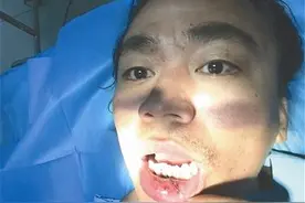 拍《大闹天竺》吊威亚出意外 王宝强受伤嘴缝10针图片