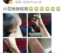 邓超哭诉被咬，网友：别冤枉小花图片