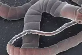 狗狗在两到三个月的时候会出现翻肠子情况，应该注意什么呢？图片