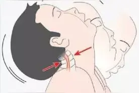 宝宝可不是你想怎么摇就怎么摇，小心婴儿摇晃综合症！图片