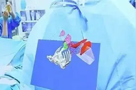 医生戴着VR眼镜，患者一下成了“透视人”图片