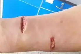 猪：我发起疯来连自己都咬图片