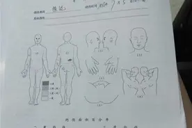 青岛市民诗婷美容院做泥灸 腰上起水泡二级灼伤图片