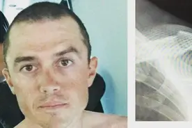 环法快讯——西蒙-格兰斯锁骨骨折退出环法赛，丹-马丁失利后表示将继续战斗，永不言弃图片