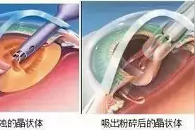 很快就开学了，神木家长到现在还不知道孩子在哪所小学吗？图片
