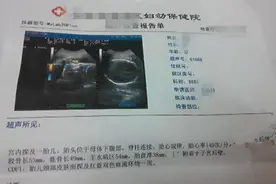 亲身验证，打破前壁后壁男宝女宝不实际的说法！图片