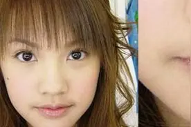 女性长胡须怎地？图片