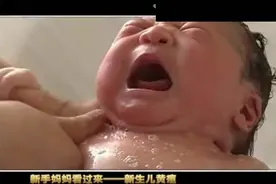 宝妈必看：重黄疸危及婴儿生命，幸存者可因神经系统受损终生致残视频封面