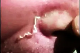 视频告诉你挤黑头对皮肤有这么多副作用，你为何还要挤？图片