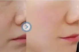 女人皮肤白不白，跟这件事绝对脱不了干系图片