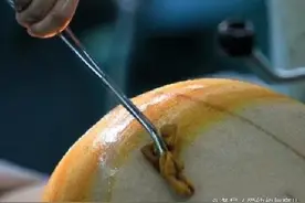 单亲宝妈讲述自己剖腹产与放环取环的经历，做宝妈的女人真难啊图片