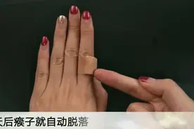 大蒜放耳朵里这么厉害？活了30年今天才知道，快告诉家人视频封面