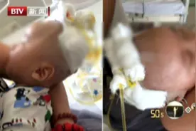 北京：父亲殴打两个月男婴致重伤，监护人资格被撤销！视频封面
