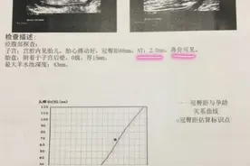 很多孕妈都不懂看的NT报告，原来是这么看的！图片