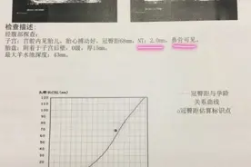 很多孕妈都不懂看的NT报告，原来是这么看的！图片