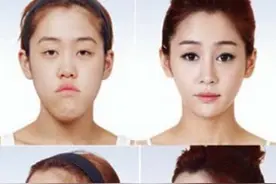 整容对命运有什么影响？图片
