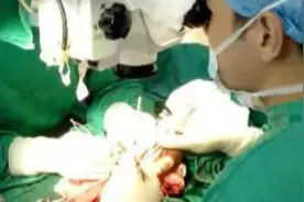 丰顺一居民被电锯切断4根手指，医生花13小时再植成功图片