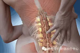 腰椎滑脱患者如何康复？图片