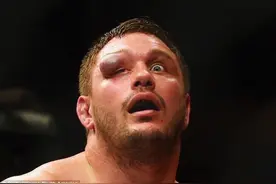 UFC选手眼部遭受重击 肿大似乒乓球惨不忍睹图片