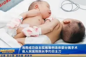 海南省首例连体婴分离手术完成 用时两个多小时图片