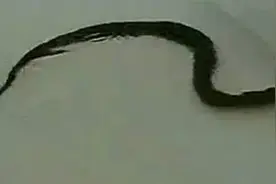 东莞“黄鳝哥”洗澡被黄鳝钻进肚 折腾五小时视频封面