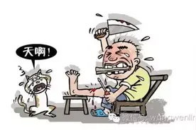 漏斗胸认识的误区（十二）：取钢板手术可以在门诊完成吗？图片