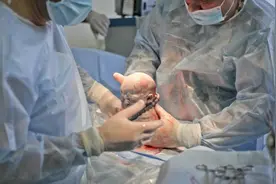 八一八剖腹产手术室的搞笑过程图片