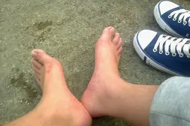 “平板脚”真的没法矫治了吗？试试这种锻炼法！图片