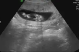 想知道宝宝14周时在妈咪肚子里的情况么？视频封面