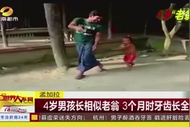 孟加拉 4岁男孩长相似老翁 3个月时牙齿长全视频封面