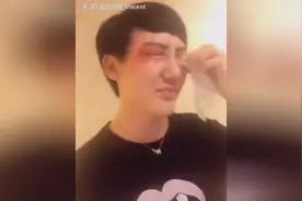 蛇精男刘梓晨出门被揍了，网友纷纷表示要给打人者送锦旗