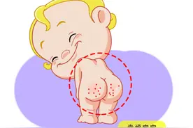 宝贝为什么会红屁股，这些事情宝妈要注意了~图片