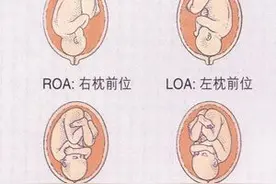 给你全面了解胎位知识，帮助选择分娩方式（上篇）图片
