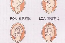 给你全面了解胎位知识，帮助选择分娩方式（上篇）图片