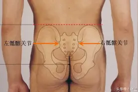 骨盆不等高，5个小妙招巧矫正！图片