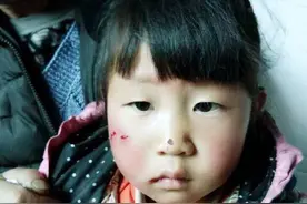 孩子，被狗咬了图片