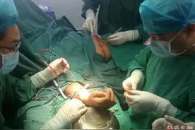 榆林星元医院十日内成功救治三名手臂重创患者图片