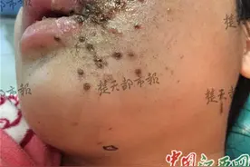 34颗铁珠射花姐姐脸 宜春一留守儿童“坑姐”图片