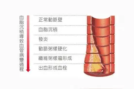 高血脂患者，你应该知道这4个事关康复的细节图片