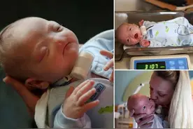 妈妈坚持生下没有鼻子的宝宝，到她两岁妈妈确认自己做对了图片