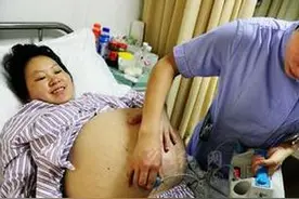 真实记录双胞胎分娩全过程图片