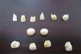 你肯定不知，乳牙竟还有如此神奇的作用？图片