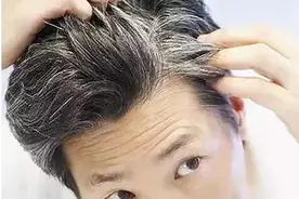 年少白发什么原因呢? 如何进行预防图片