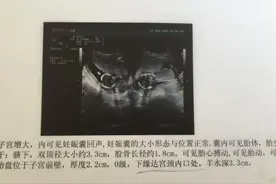 孕妈妈怀孕四个月见红，检查胎盘低置，医生建议这么做！图片